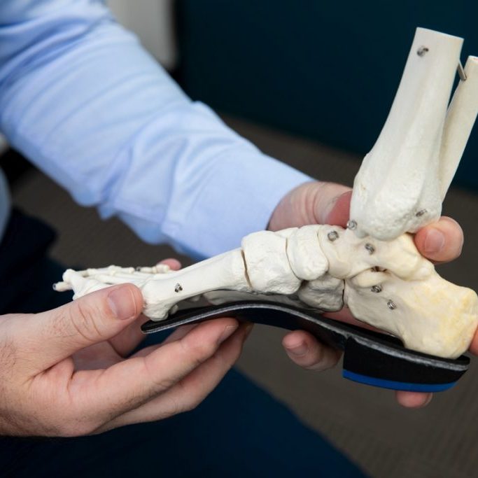 Customised Foot Orthotics