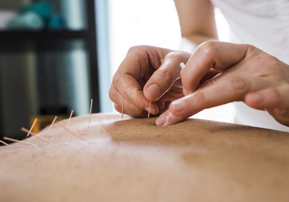 the-dymocks-building-shops-Dr-Kirk-Wilson-Acupuncture-TCM